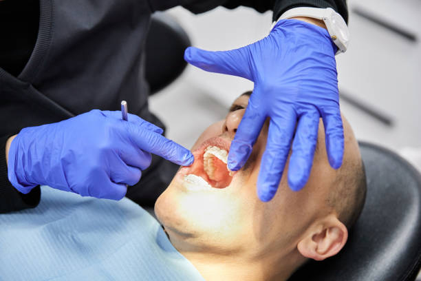 Best Knocked-Out Tooth (Avulsed Tooth) Treatment in Prairie View, TX
